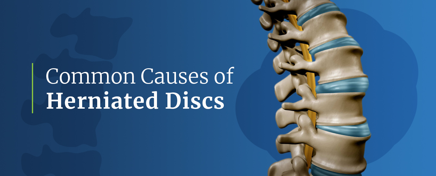 common causes of herniated discs