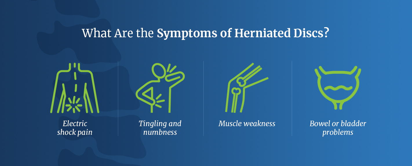 what are the symptoms of herniated discs