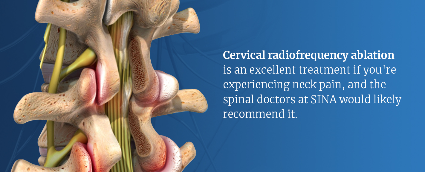 cervical radiofrequency ablation